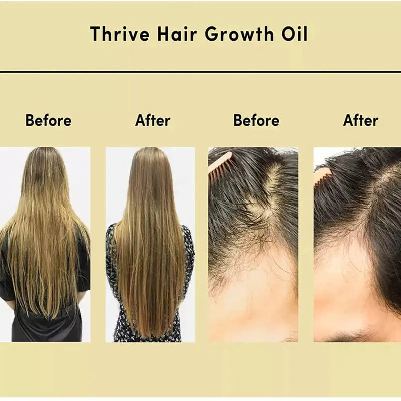 Natural Hair Growth Oil
