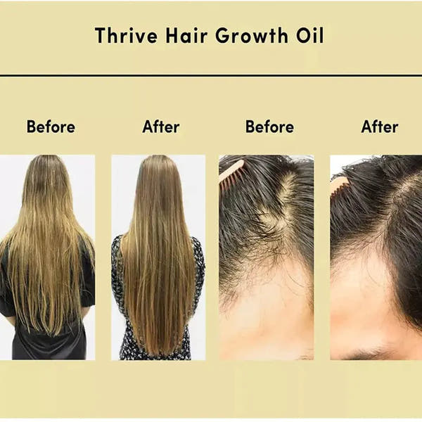Natural Hair Growth Oil